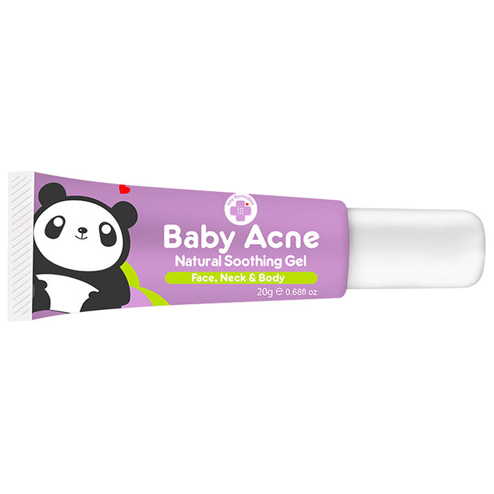 Tiny Remedies Baby Acne Natural Soothing Gel 20g
